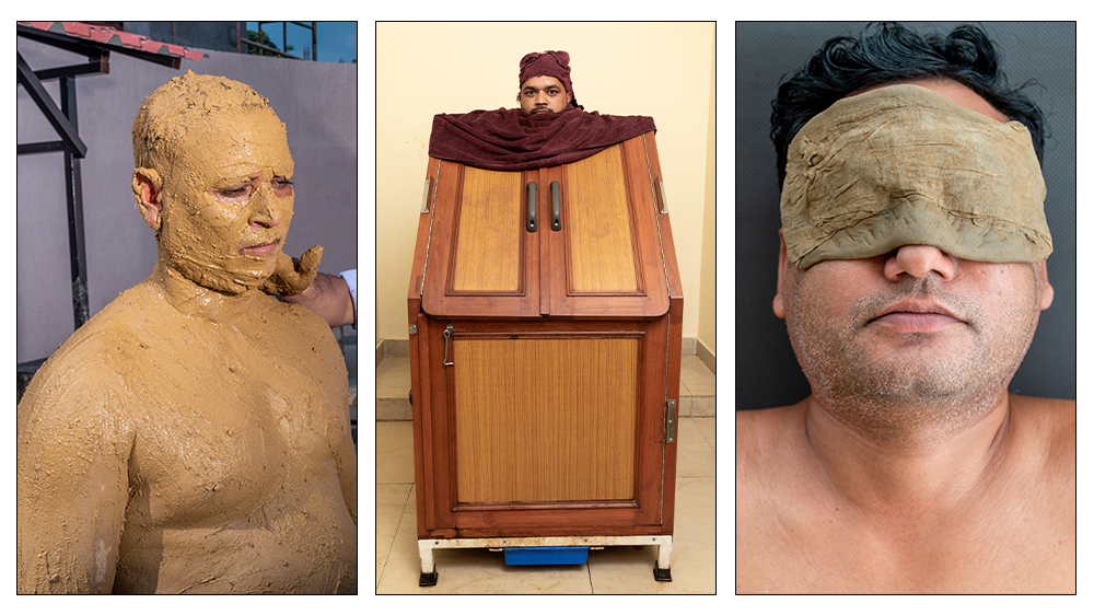 Naturopathy Treatment In Delhi